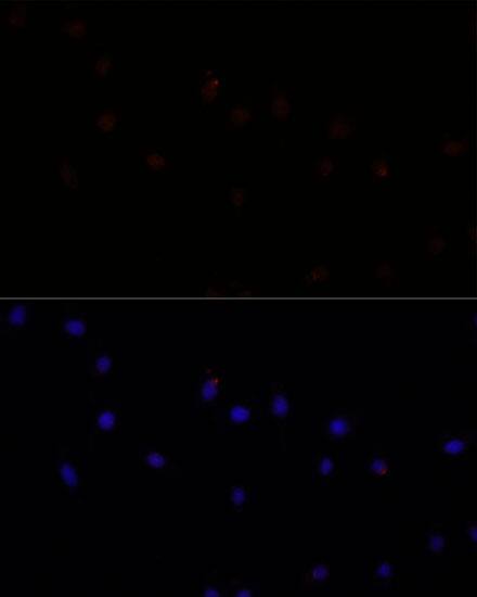 Calpain 7 Antibody - Azide and BSA Free