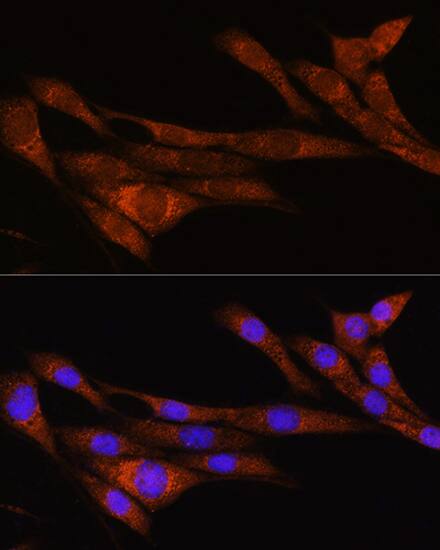 ARHGAP30 Antibody - Azide and BSA Free