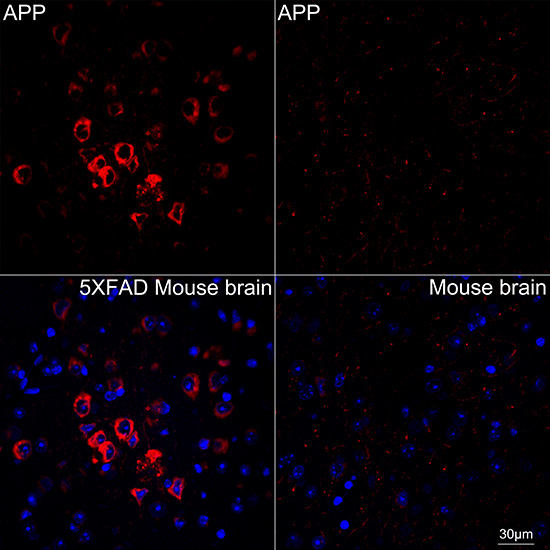 APP Antibody (3A8S2)