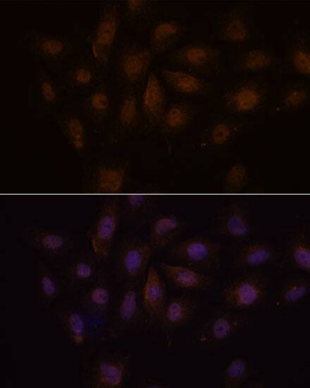 MED15 Antibody - Azide and BSA Free