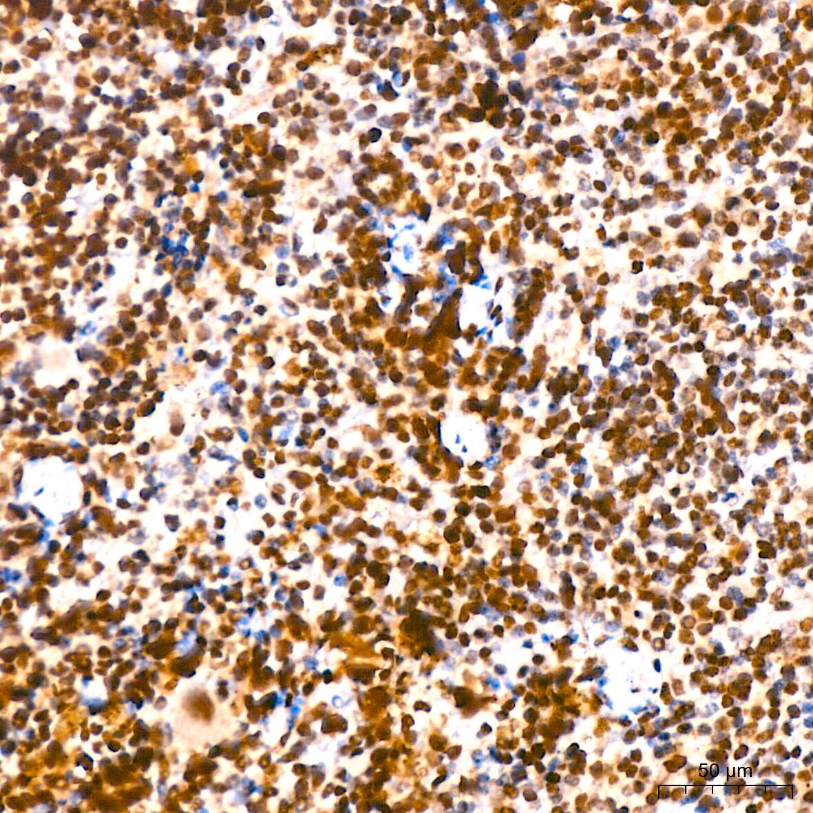 HIST1H2AB Antibody (1P5B6)