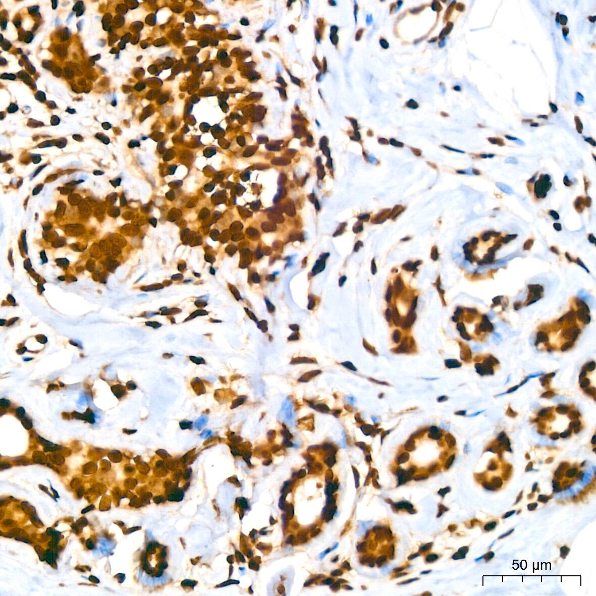 HIST1H2AB Antibody (1P5B6)