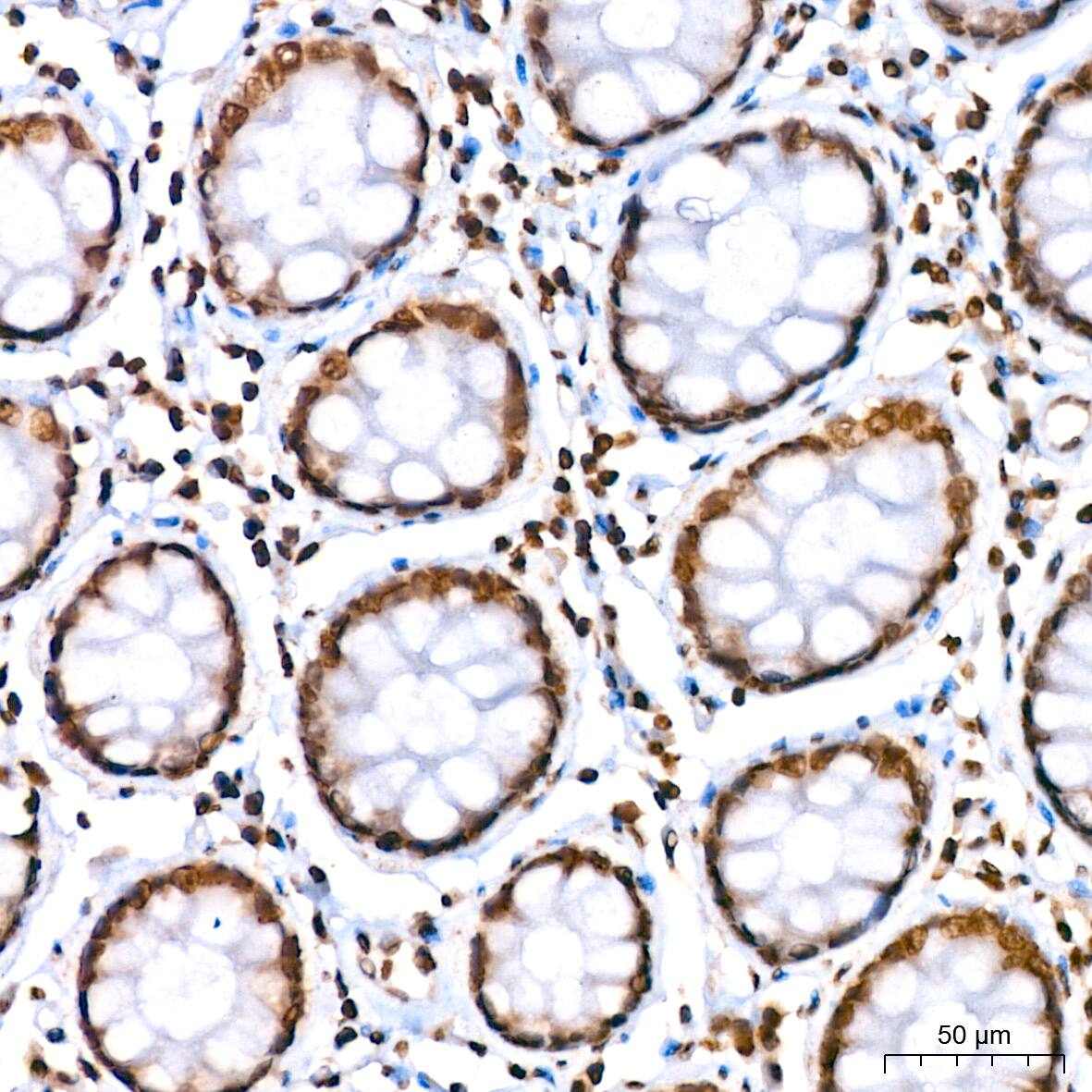 HIST1H2AB Antibody (1P5B6)