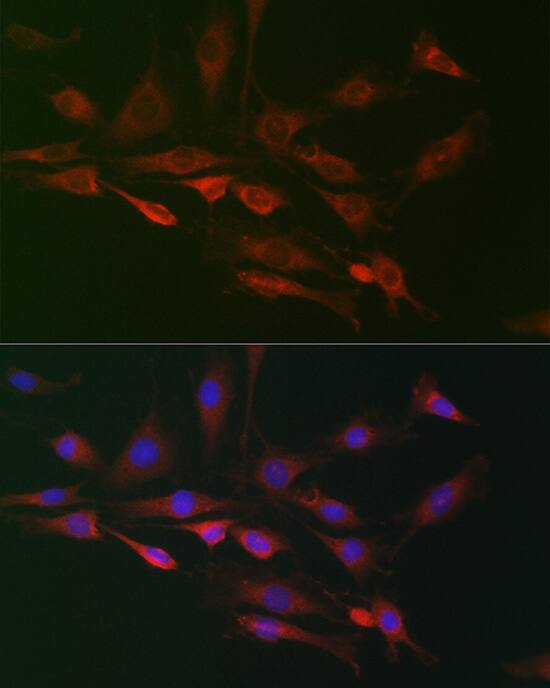 RAI16 Antibody - Azide and BSA Free