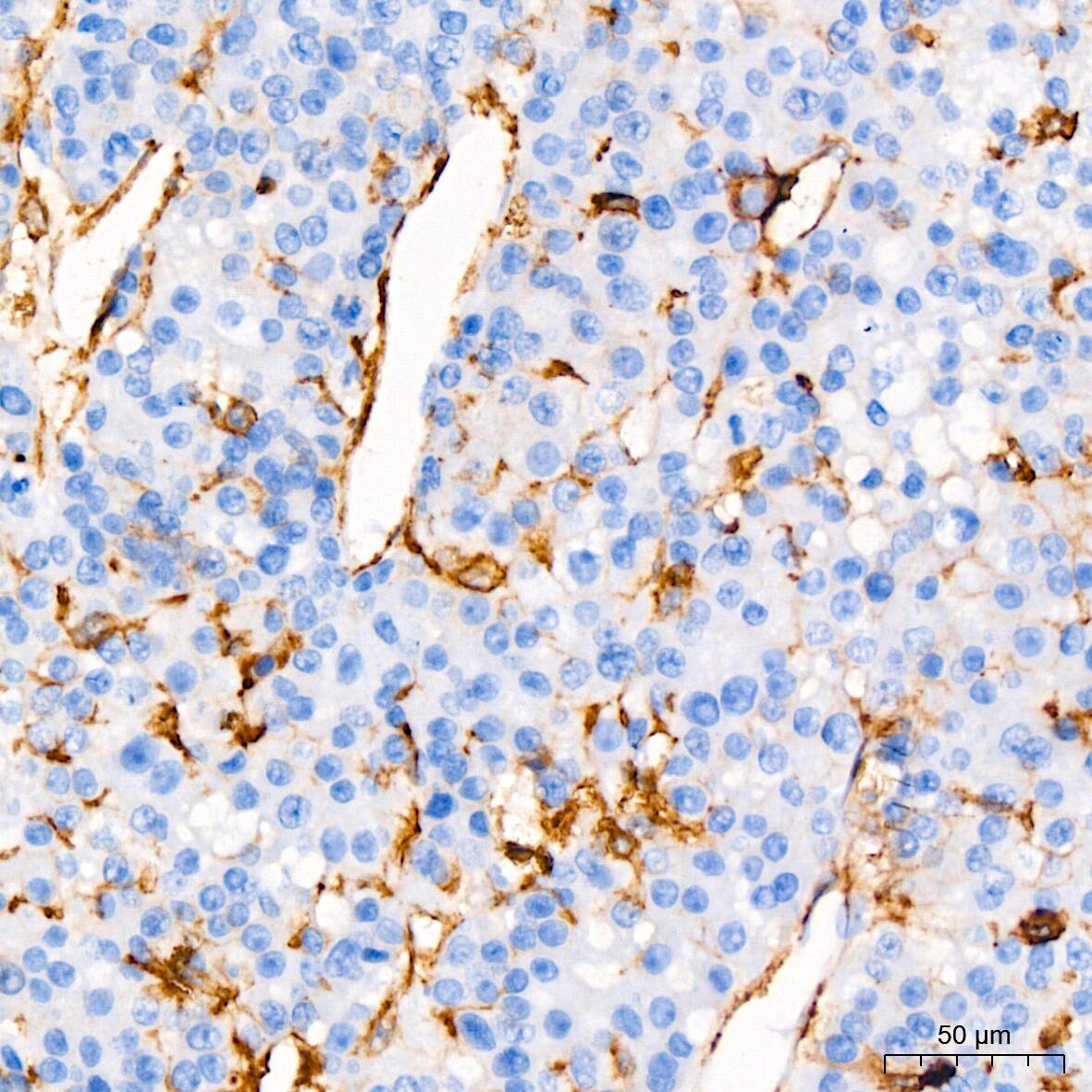 CD44 Antibody (9W6E7)