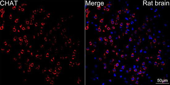 Choline Acetyltransferase/ChAT Antibody (1I4V0)