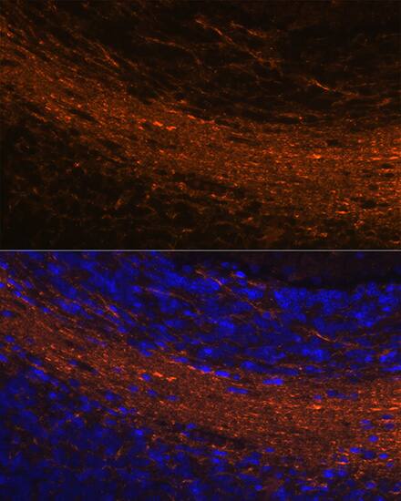 CNPase Antibody (8O3B6)