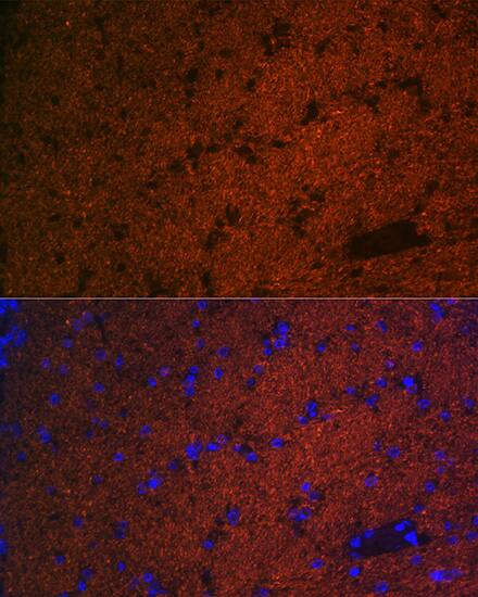 CNPase Antibody (8O3B6)