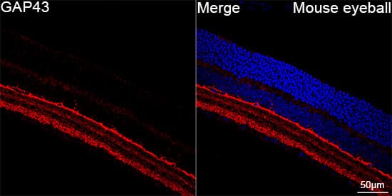 GAP-43 Antibody (8E7C8)