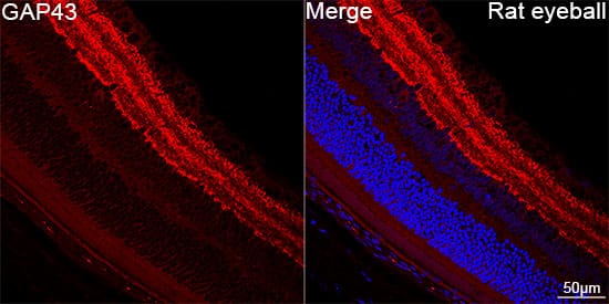 GAP-43 Antibody (8E7C8)