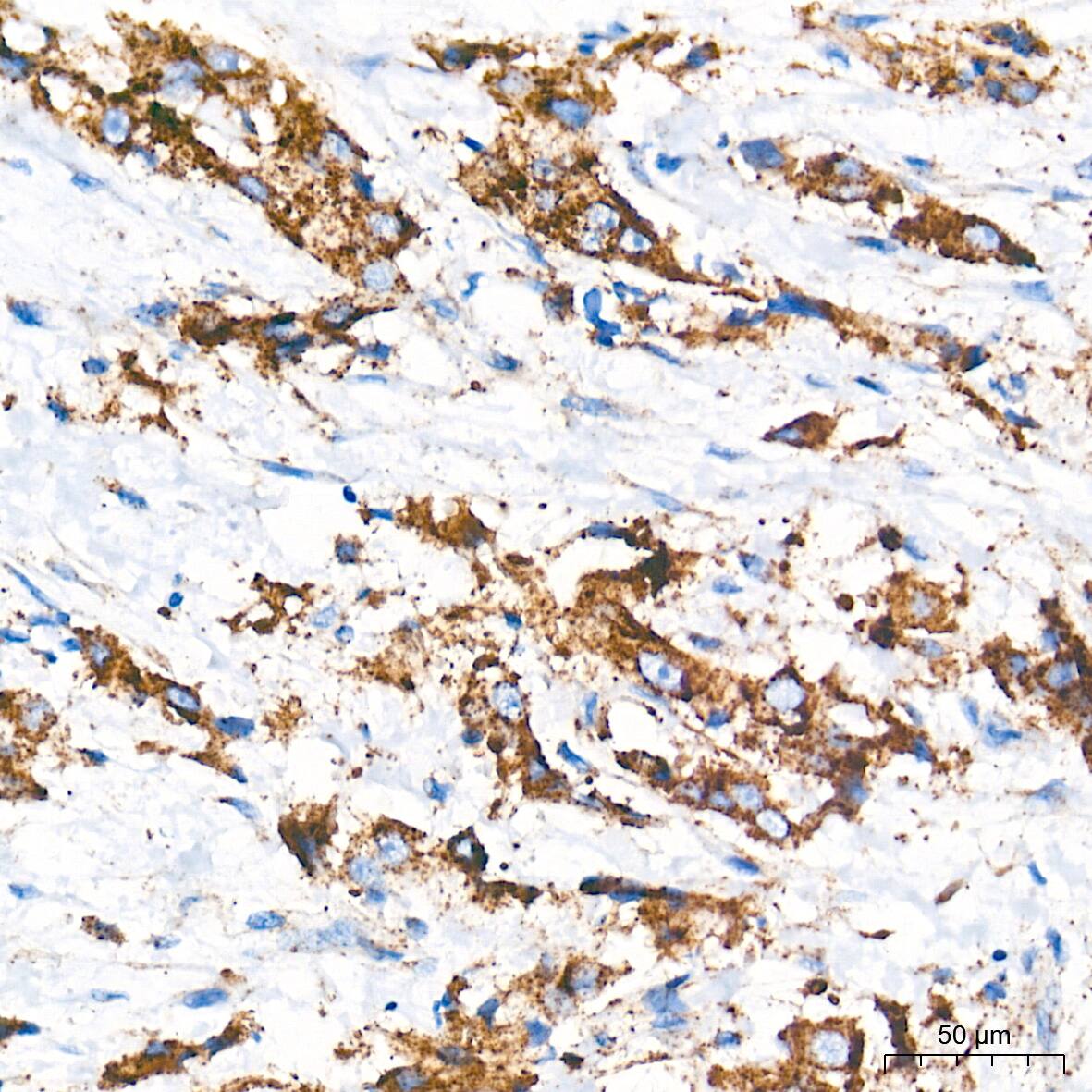 Glucosylceramidase/GBA Antibody (8O3Z7)