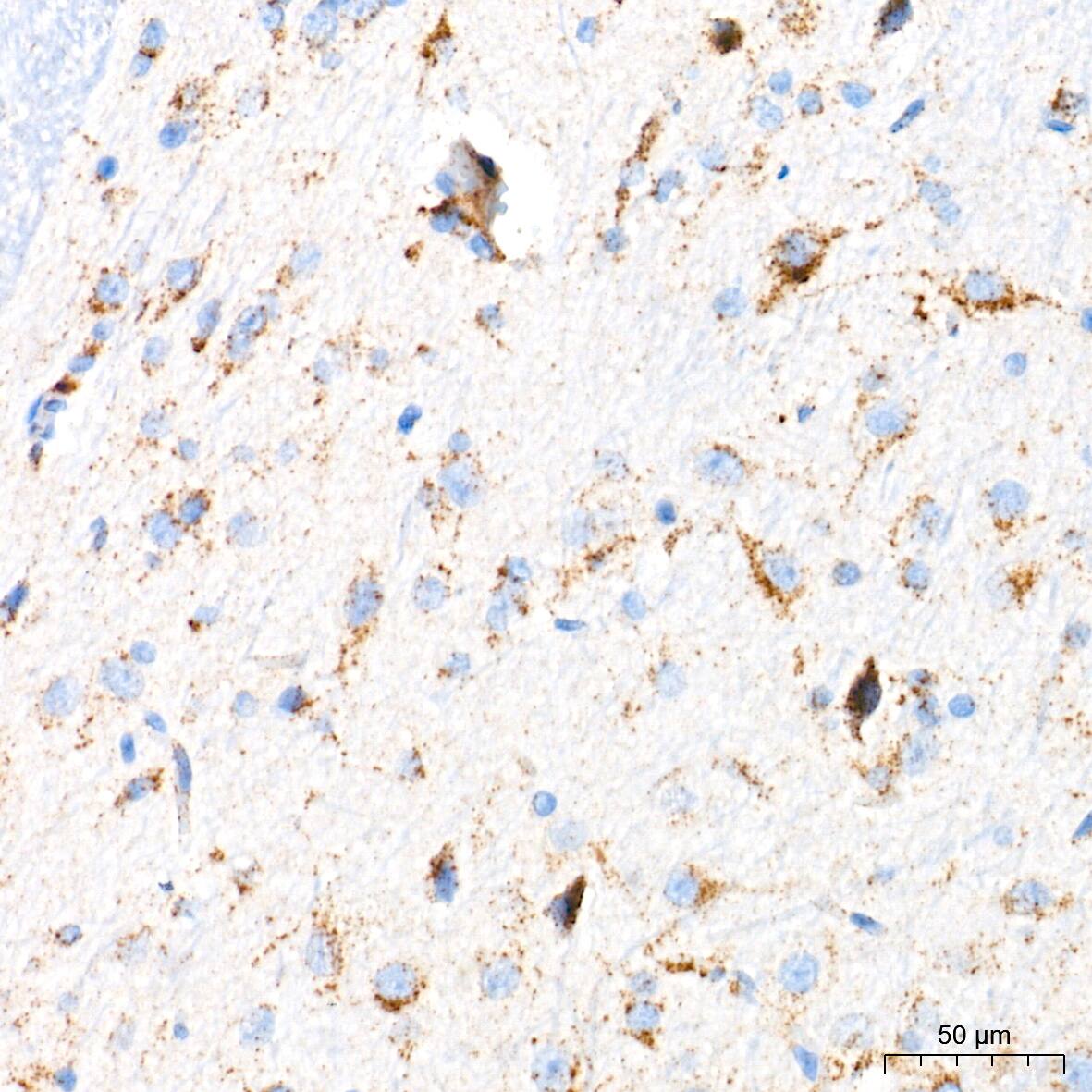 Glucosylceramidase/GBA Antibody (8O3Z7)