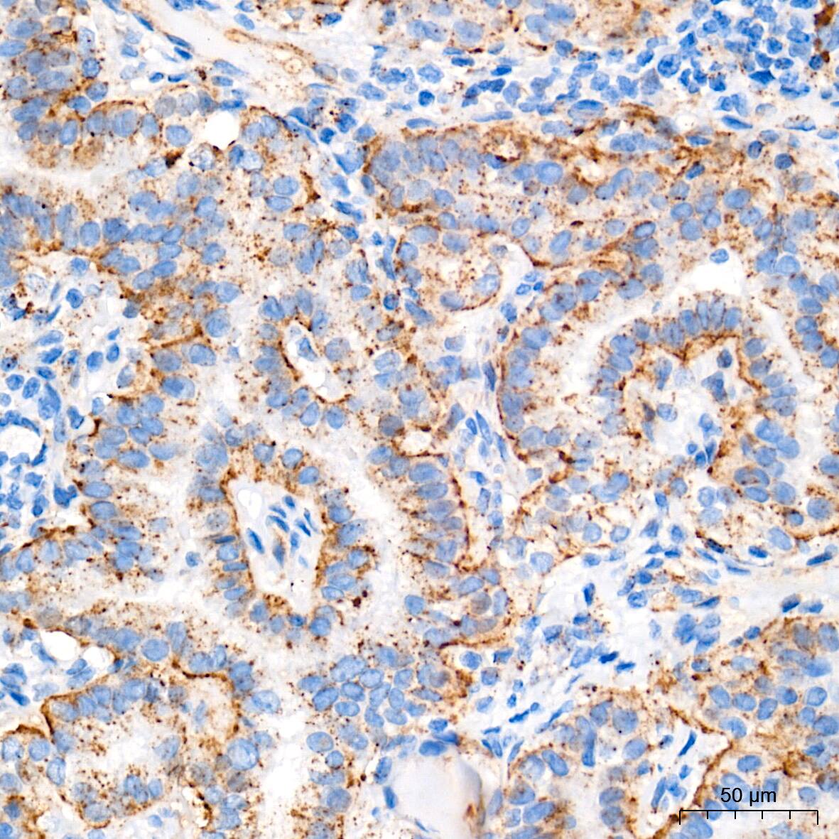 Glucosylceramidase/GBA Antibody (8O3Z7)