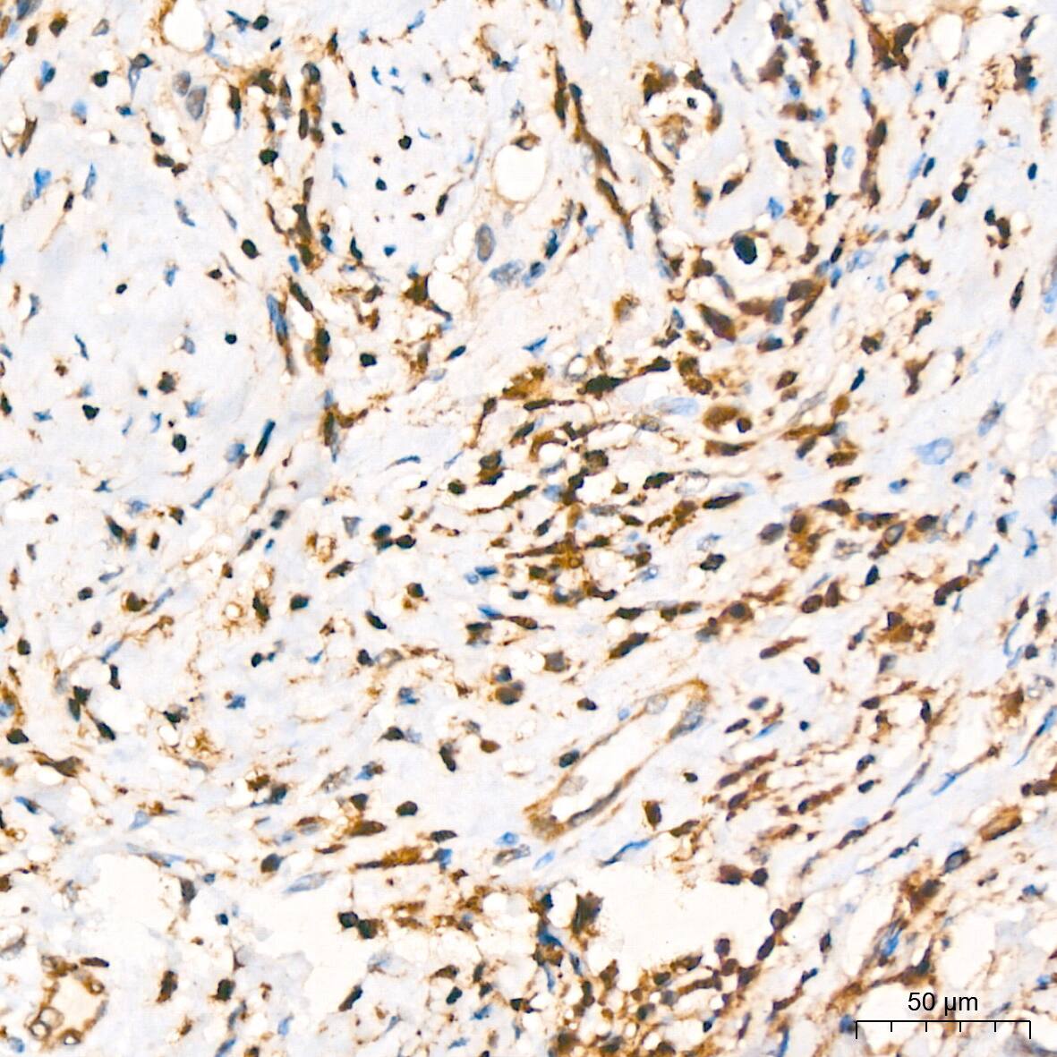 GRB2 Antibody (9K6H0)
