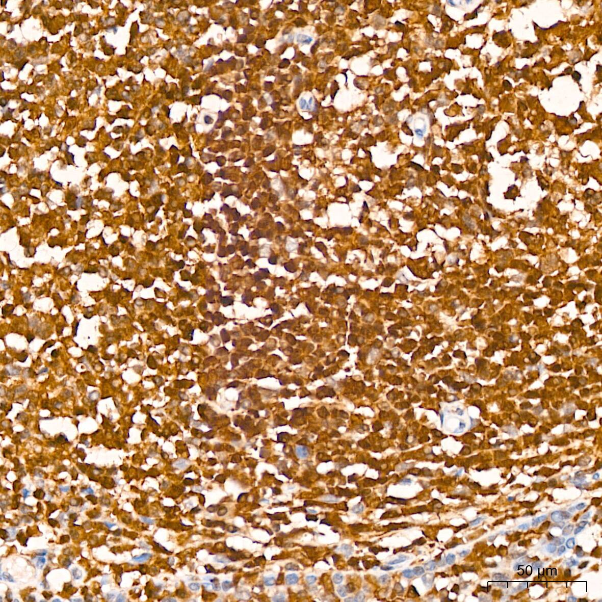 GRB2 Antibody (9K6H0)