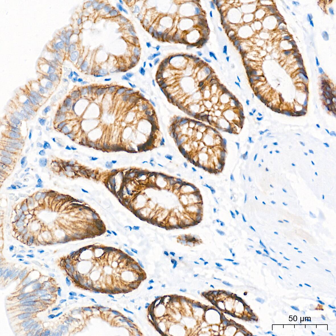 Integrin alpha 2/CD49b Antibody (7O9H6)