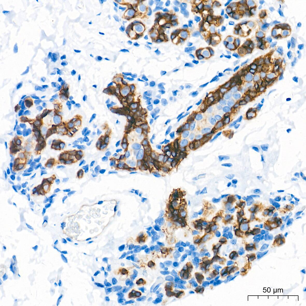 Integrin alpha 2/CD49b Antibody (7O9H6)