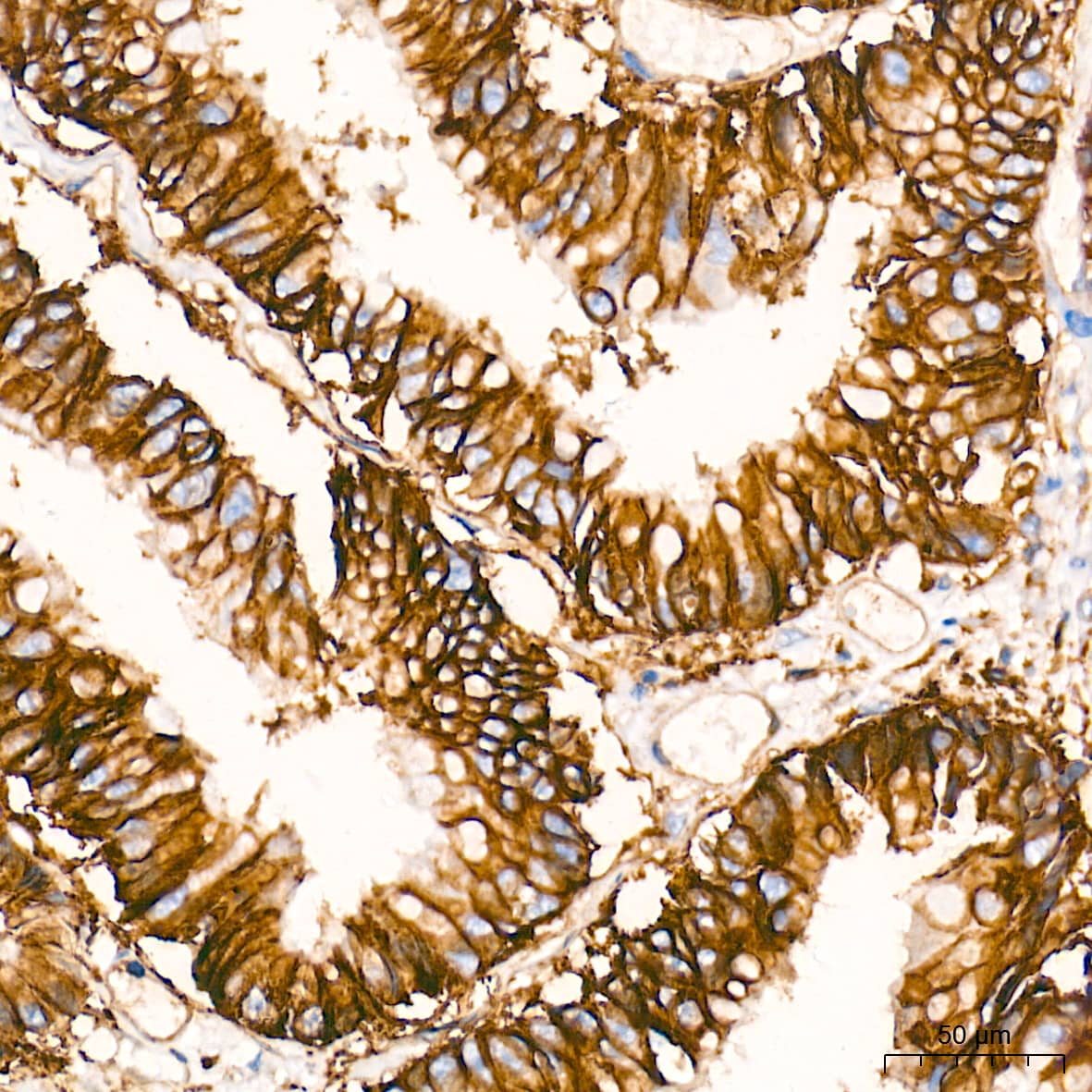 Integrin alpha 2/CD49b Antibody (7O9H6)