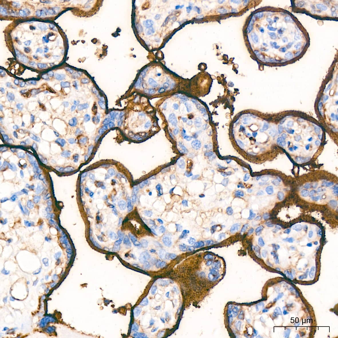 Integrin alpha 5/CD49e Antibody (8F2O6)