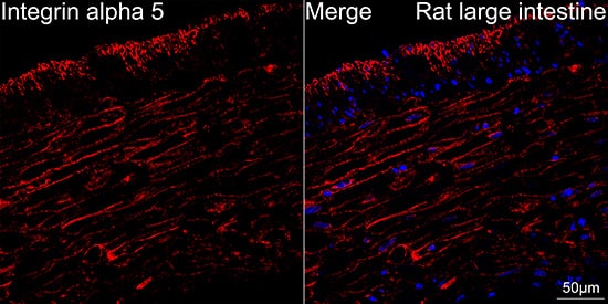 Integrin alpha 5/CD49e Antibody (8F2O6)