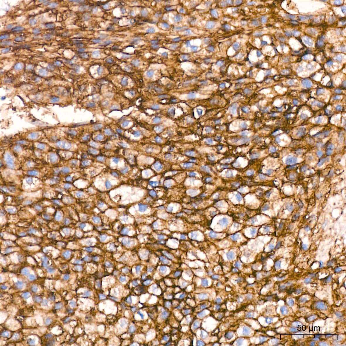 Integrin alpha 5/CD49e Antibody (8F2O6)