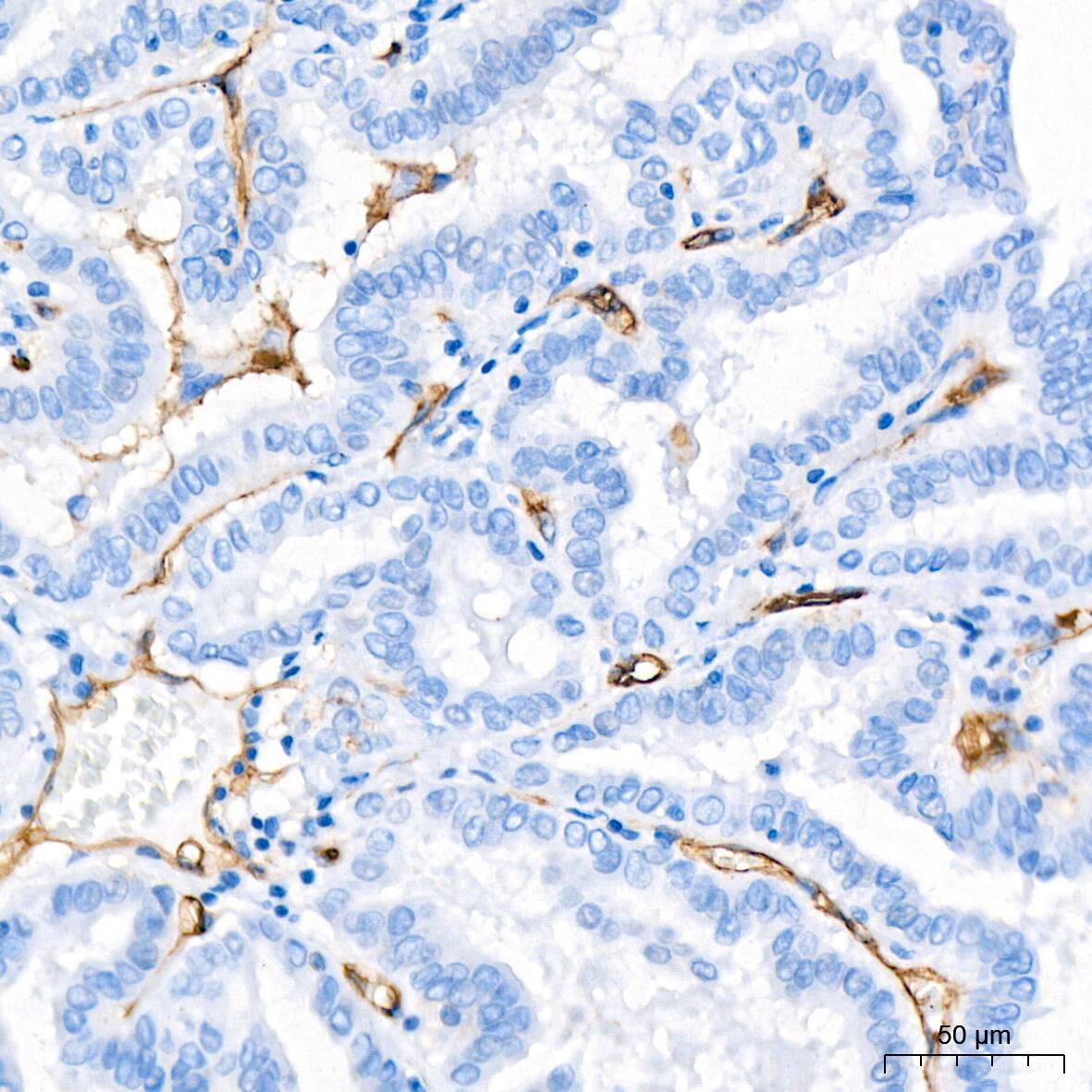 Integrin alpha 5/CD49e Antibody (8F2O6)