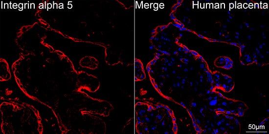 Integrin alpha 5/CD49e Antibody (8F2O6)