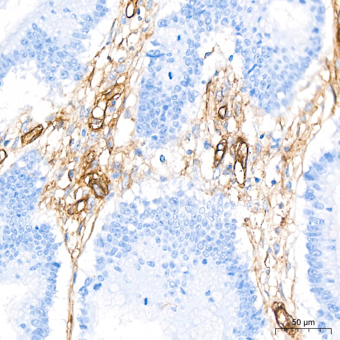 Integrin alpha 5/CD49e Antibody (8F2O6)