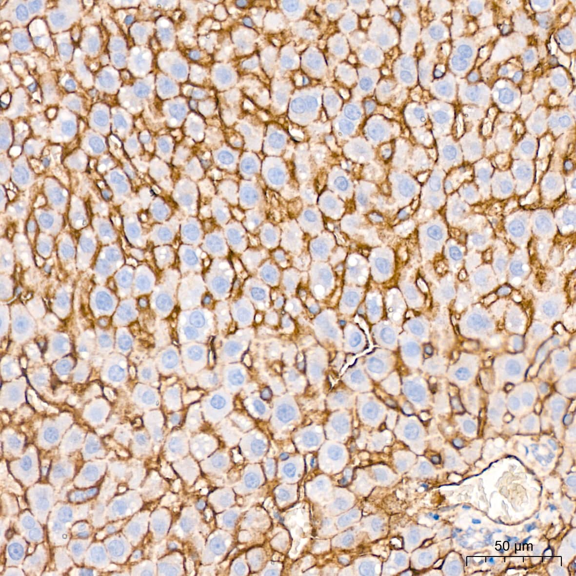 Integrin alpha 5/CD49e Antibody (8F2O6)