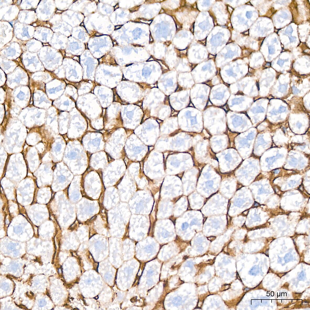Integrin alpha 5/CD49e Antibody (8F2O6)