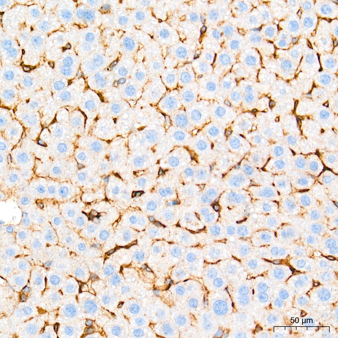 Integrin alpha V/CD51 Antibody (10T9N2)