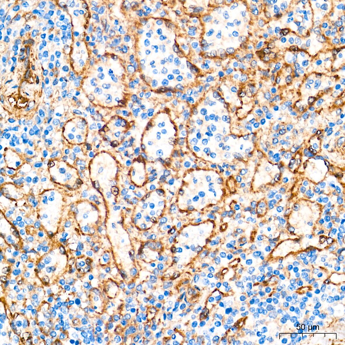 Integrin alpha V/CD51 Antibody (10T9N2)