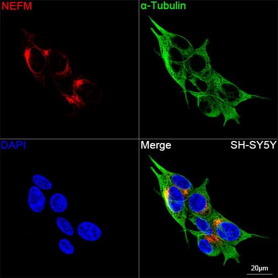 NF-M Antibody (5E0D2)