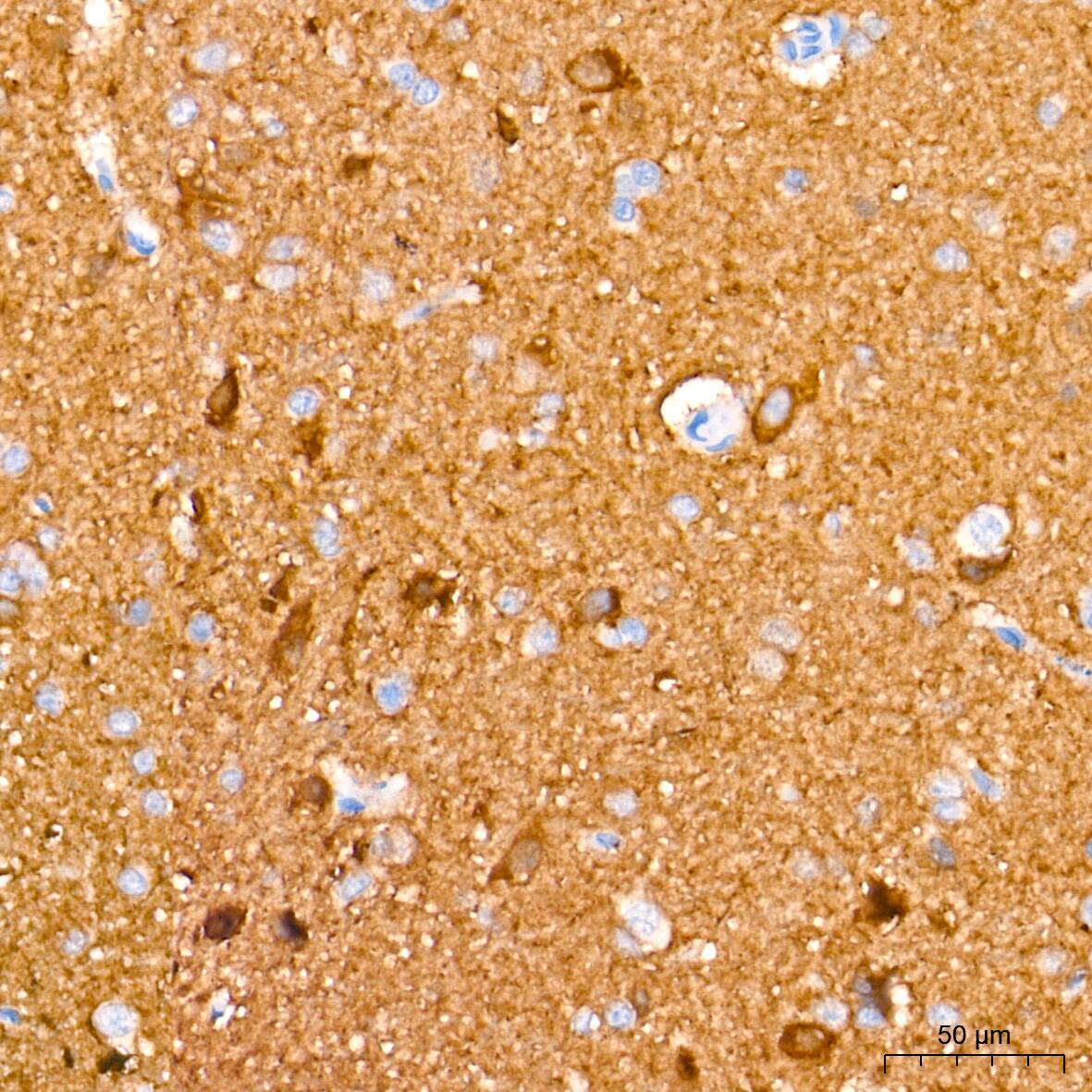 Enolase 2/Neuron-specific Enolase Antibody (9B4Y4)