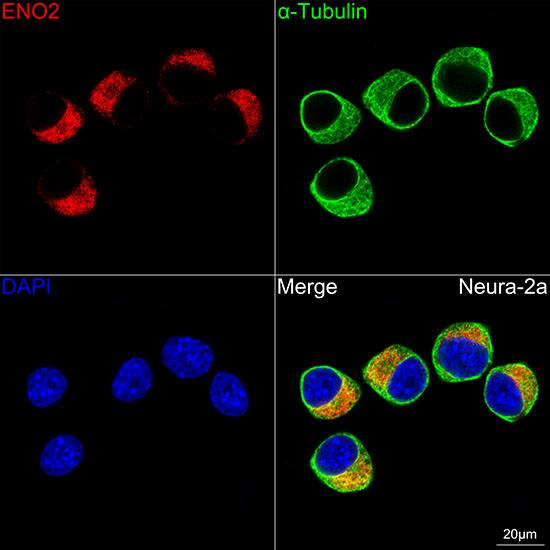 Enolase 2/Neuron-specific Enolase Antibody (9B4Y4)