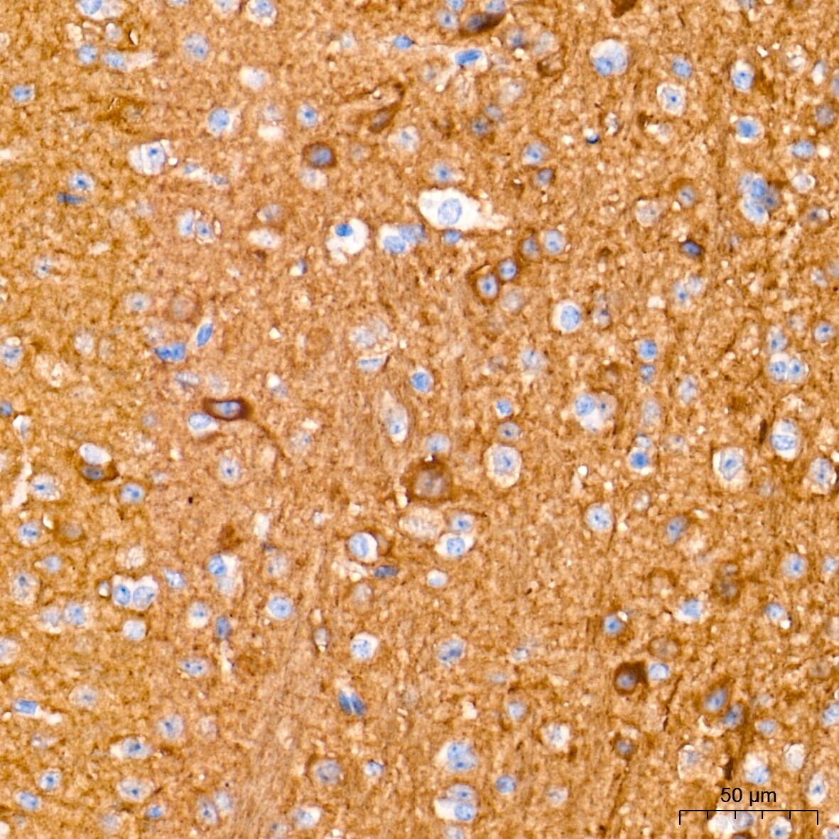 Enolase 2/Neuron-specific Enolase Antibody (9B4Y4)