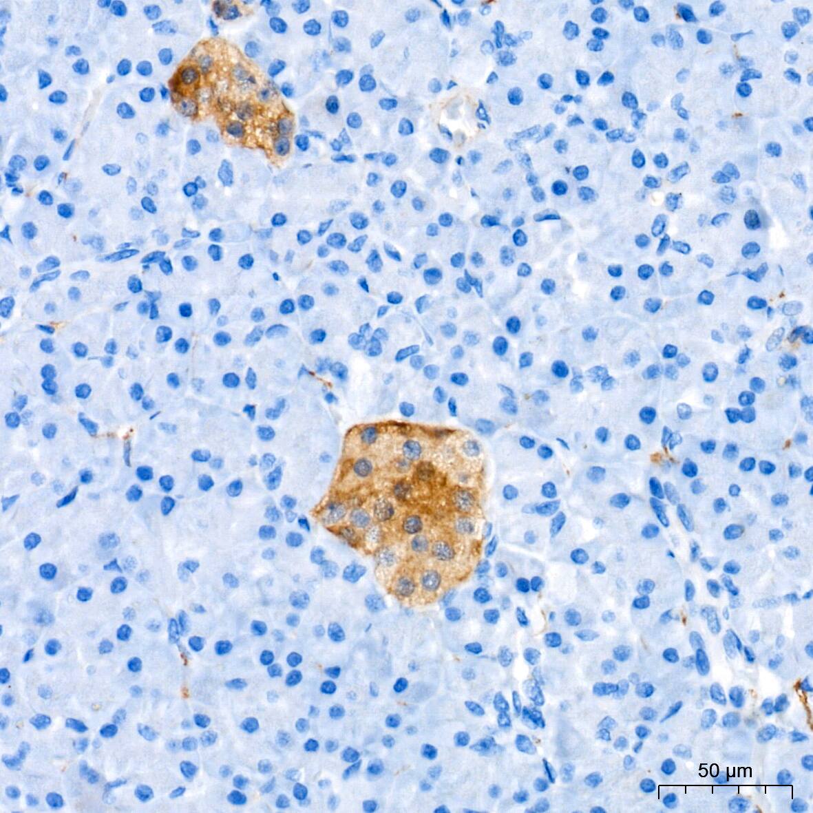 Enolase 2/Neuron-specific Enolase Antibody (9B4Y4)