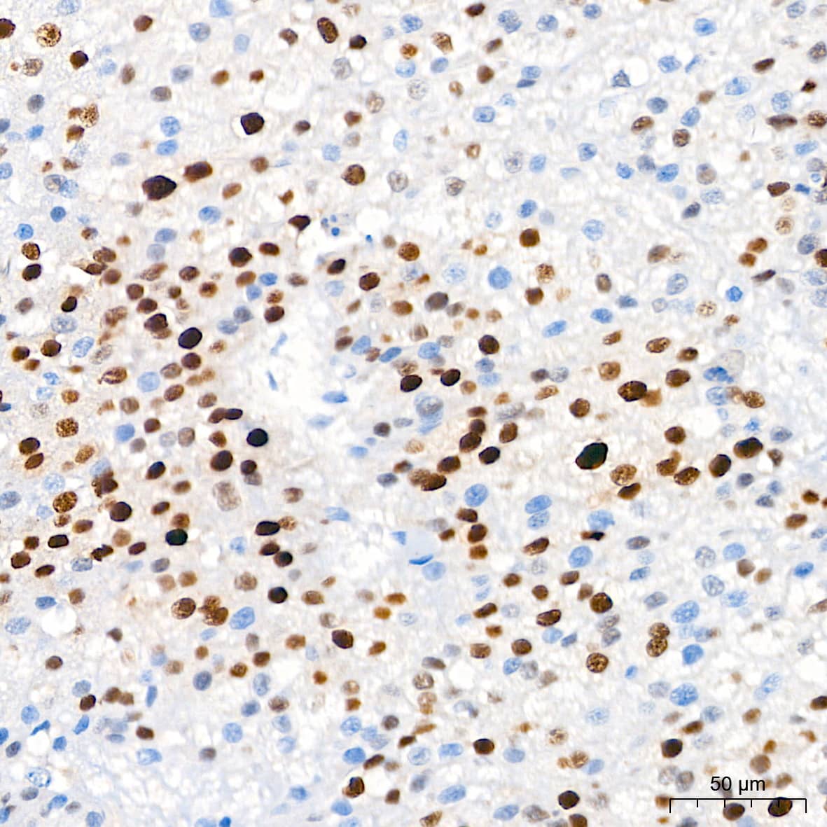 p21/CIP1/CDKN1A Antibody (4Z1H9)
