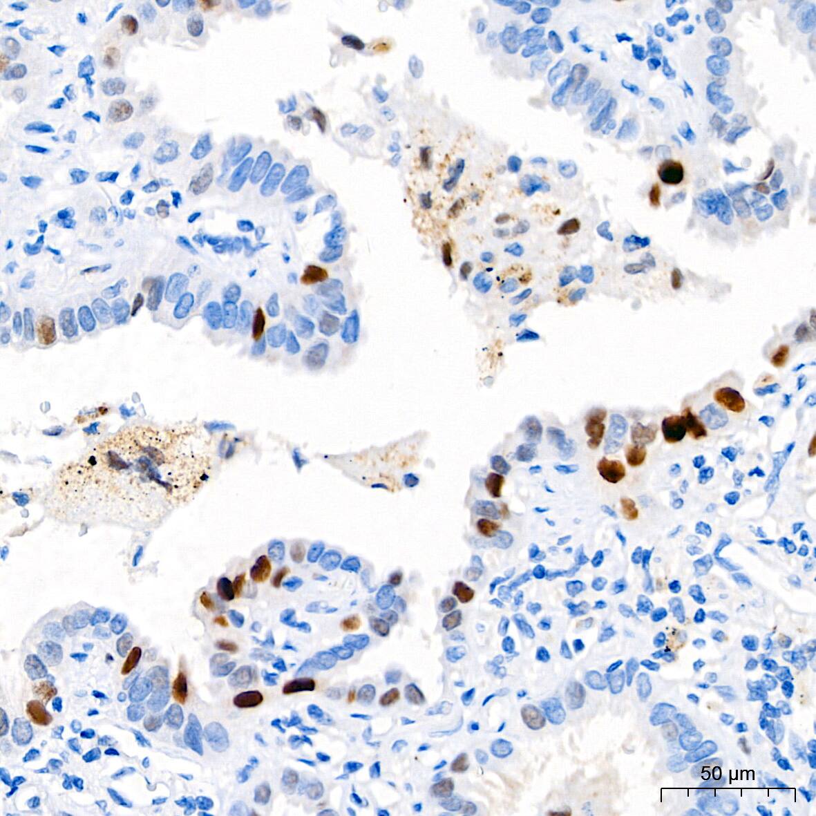 p21/CIP1/CDKN1A Antibody (4Z1H9)