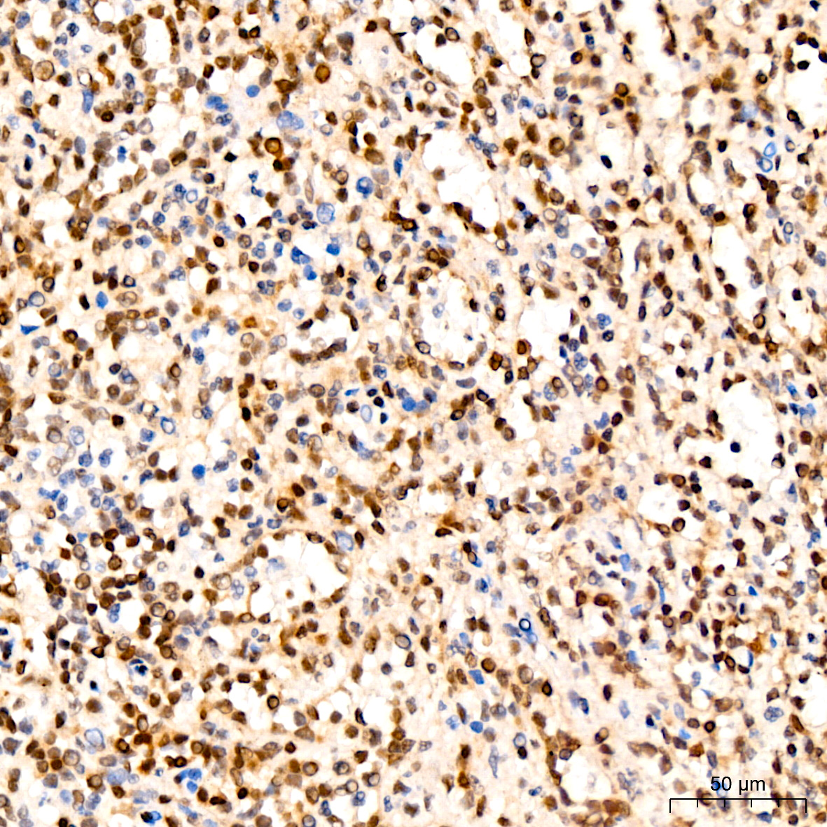 p27/Kip1 Antibody (9R5B4)