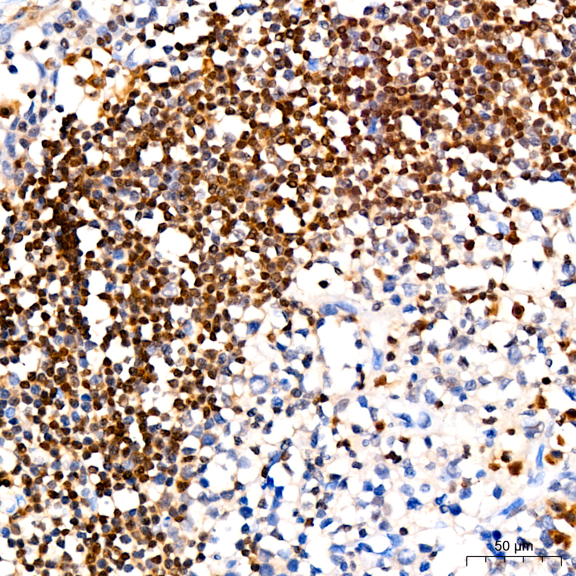 p27/Kip1 Antibody (9R5B4)