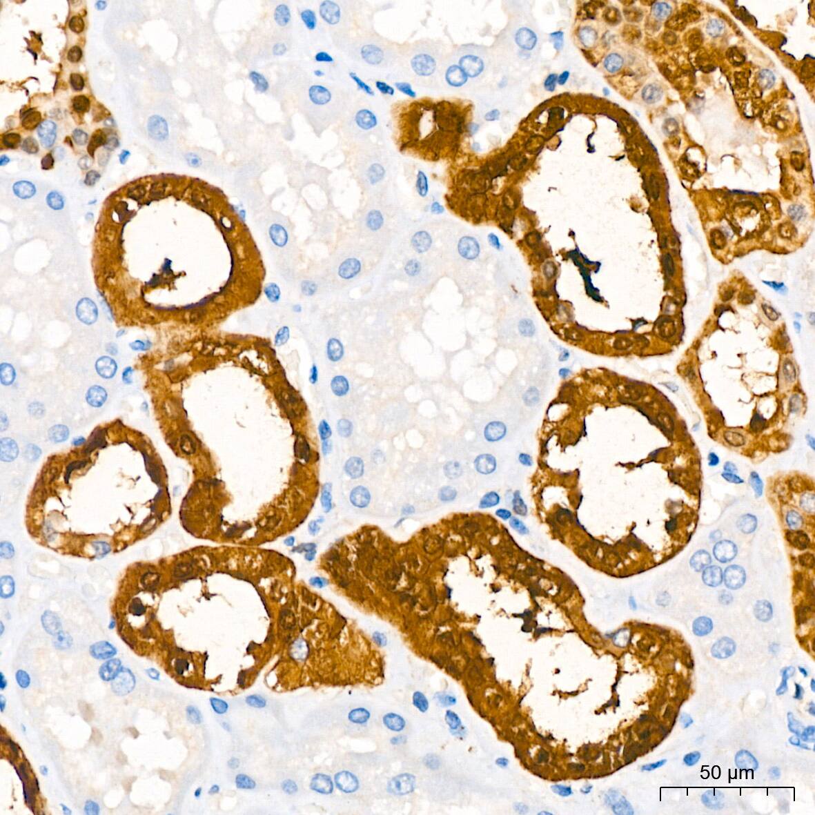 Parvalbumin Antibody (6C7K6)