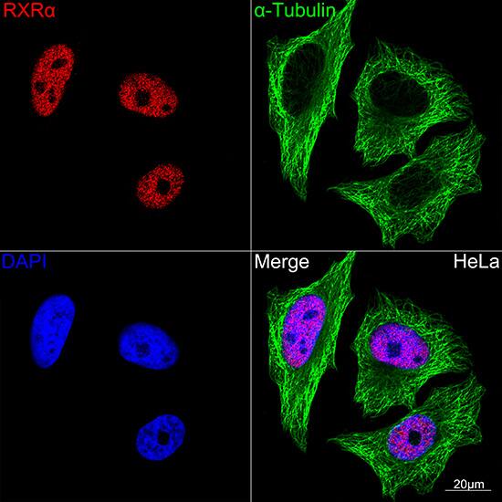 RXR alpha/NR2B1 Antibody (6Y10M1)