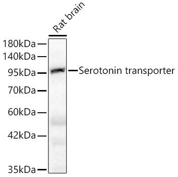 SLC6A4/5-HTTLPR/Serotonin transporter Antibody (5T7M2)