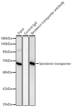 SLC6A4/5-HTTLPR/Serotonin transporter Antibody (5T7M2)