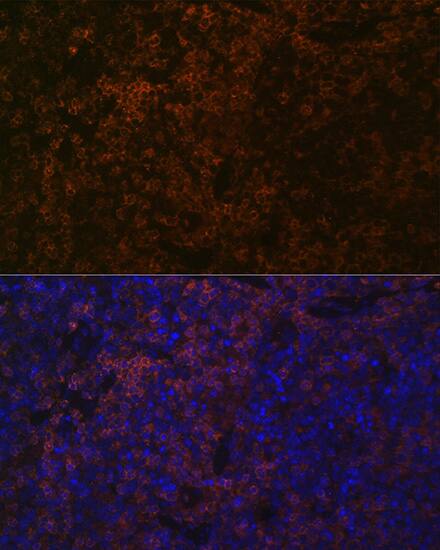 SHP-1 Antibody (7I1K3)