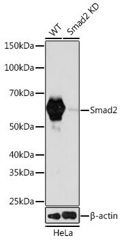 Smad2 Antibody (2E3D8)