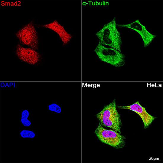 Smad2 Antibody (2E3D8)