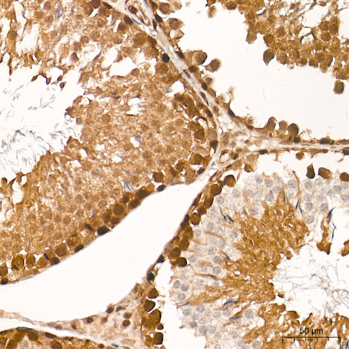 Smad4 Antibody (6B4D6)