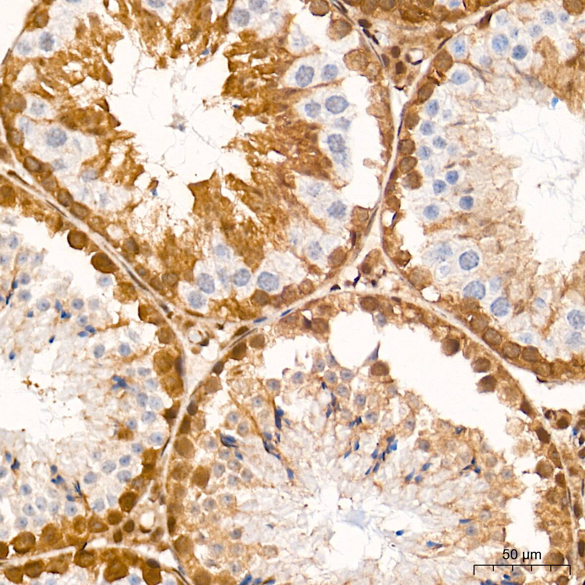 Smad4 Antibody (6B4D6)